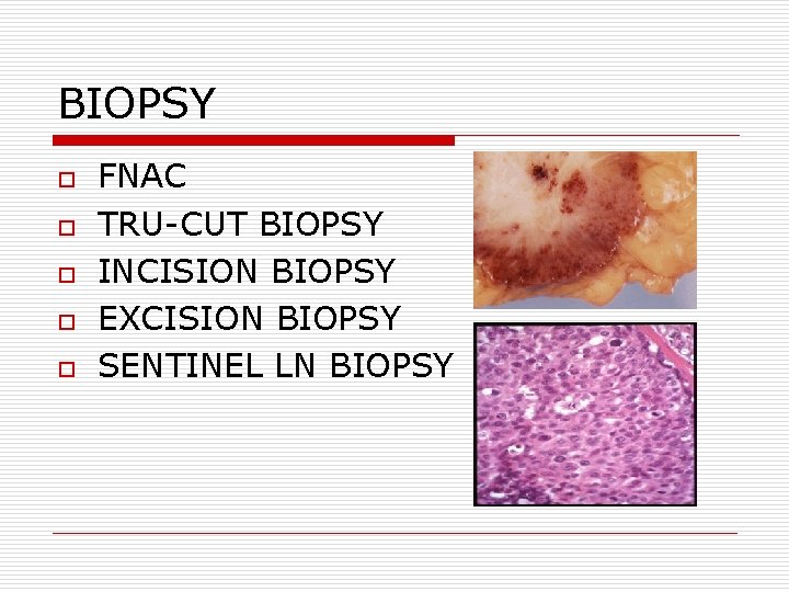 BIOPSY o o o FNAC TRU-CUT BIOPSY INCISION BIOPSY EXCISION BIOPSY SENTINEL LN BIOPSY BIOPSY o o o FNAC TRU-CUT BIOPSY INCISION BIOPSY EXCISION BIOPSY SENTINEL LN BIOPSY