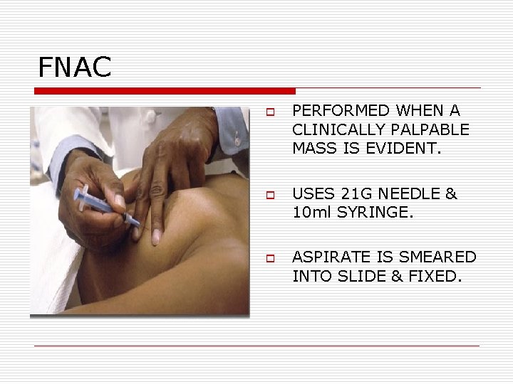 FNAC o o o PERFORMED WHEN A CLINICALLY PALPABLE MASS IS EVIDENT. USES 21 FNAC o o o PERFORMED WHEN A CLINICALLY PALPABLE MASS IS EVIDENT. USES 21