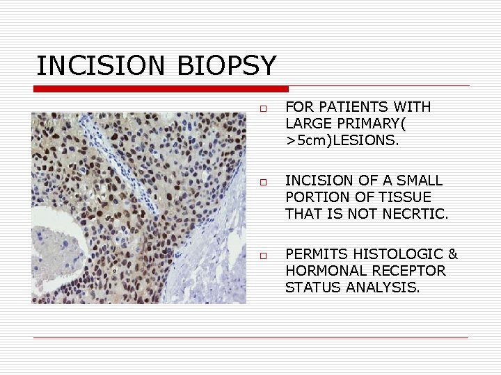 INCISION BIOPSY o o o FOR PATIENTS WITH LARGE PRIMARY( >5 cm)LESIONS. INCISION OF INCISION BIOPSY o o o FOR PATIENTS WITH LARGE PRIMARY( >5 cm)LESIONS. INCISION OF