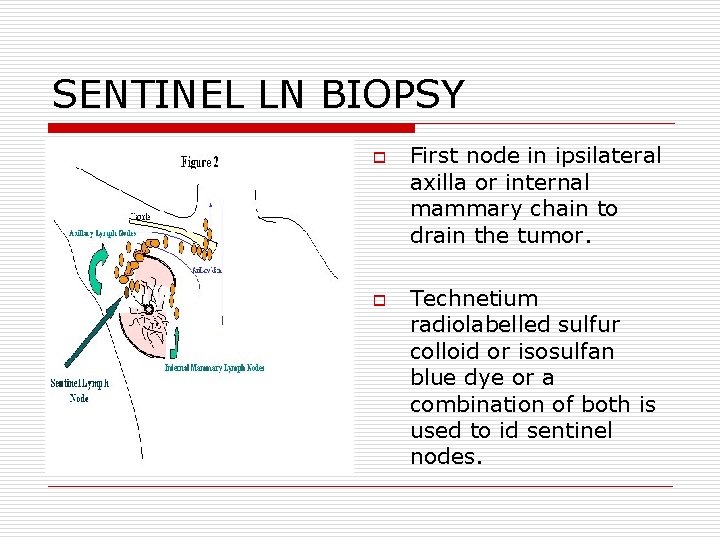 SENTINEL LN BIOPSY o o First node in ipsilateral axilla or internal mammary chain SENTINEL LN BIOPSY o o First node in ipsilateral axilla or internal mammary chain