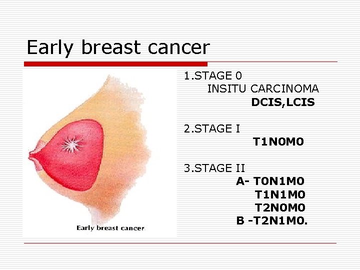 Early breast cancer 1. STAGE 0 INSITU CARCINOMA DCIS, LCIS 2. STAGE I T Early breast cancer 1. STAGE 0 INSITU CARCINOMA DCIS, LCIS 2. STAGE I T