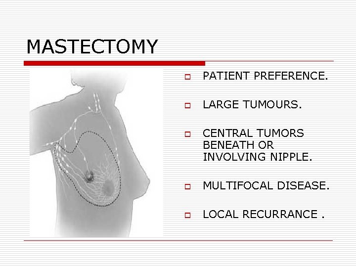 MASTECTOMY o PATIENT PREFERENCE. o LARGE TUMOURS. o CENTRAL TUMORS BENEATH OR INVOLVING NIPPLE. MASTECTOMY o PATIENT PREFERENCE. o LARGE TUMOURS. o CENTRAL TUMORS BENEATH OR INVOLVING NIPPLE.