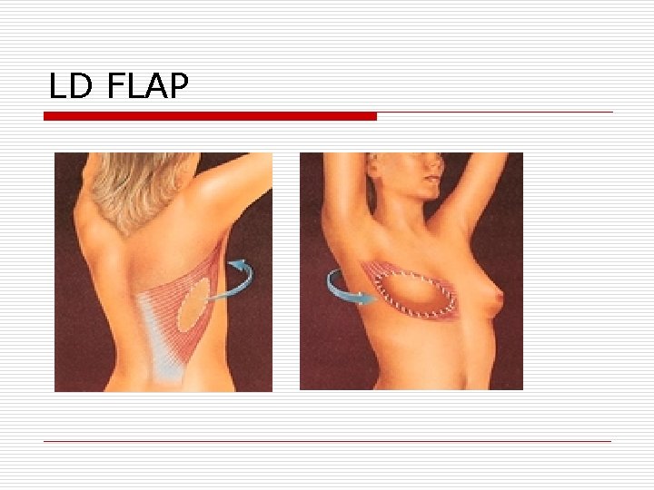 LD FLAP LD FLAP