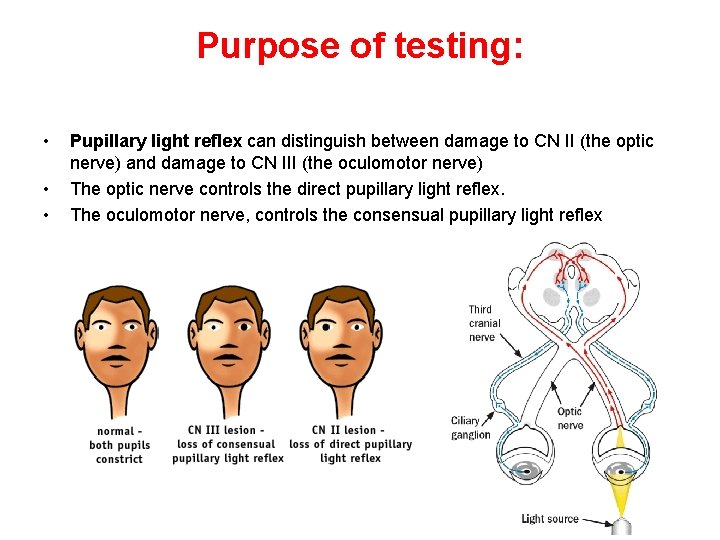 Purpose of testing: • • • Pupillary light reflex can distinguish between damage to Purpose of testing: • • • Pupillary light reflex can distinguish between damage to