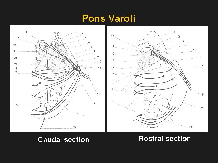 Pons Varoli Caudal section Rostral section 