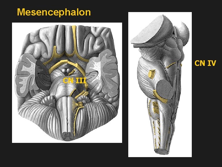 Mesencephalon CN IV CN III 