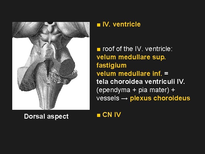 ■ IV. ventricle ■ roof of the IV. ventricle: velum medullare sup. fastigium velum