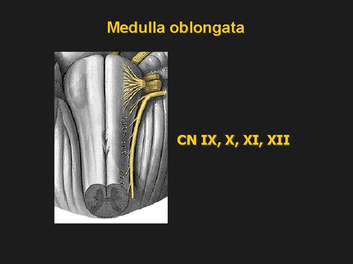 Medulla oblongata CN IX, X, XII 