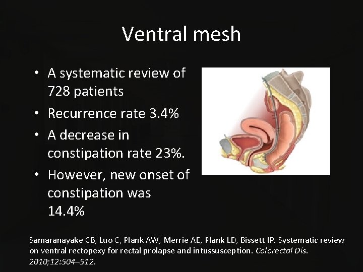 Ventral mesh • A systematic review of 728 patients • Recurrence rate 3. 4%