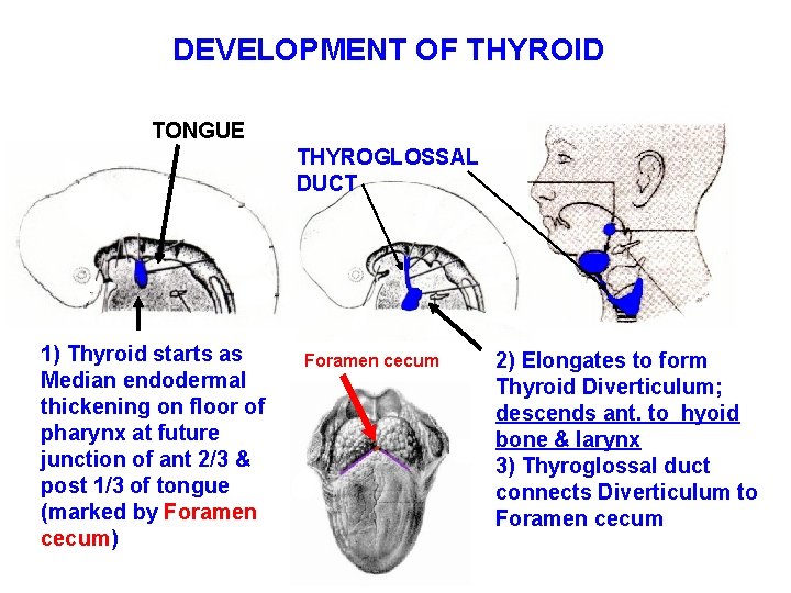 DEVELOPMENT OF THYROID TONGUE THYROGLOSSAL DUCT 1) Thyroid starts as Median endodermal thickening on