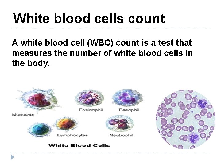 White blood cells count A white blood cell (WBC) count is a test that