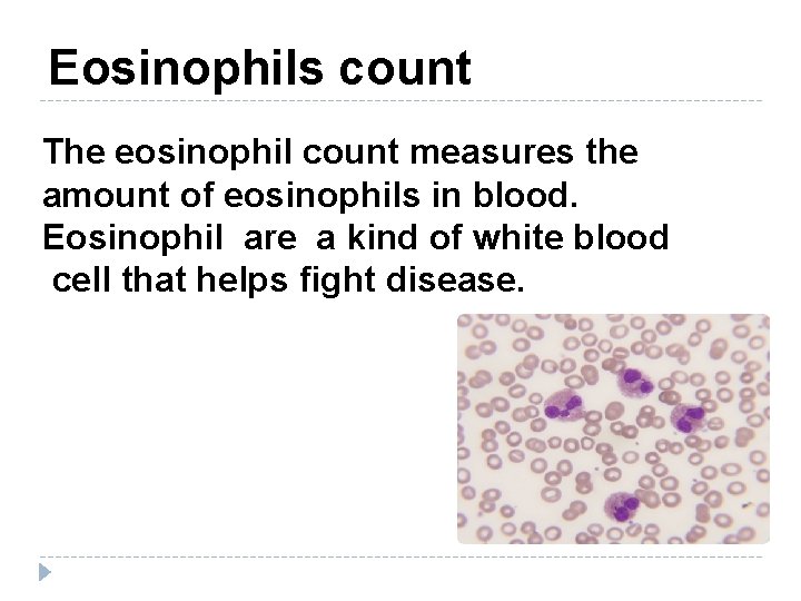 Eosinophils count The eosinophil count measures the amount of eosinophils in blood. Eosinophil are