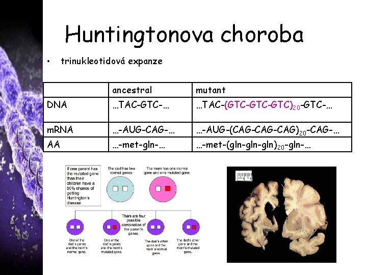 Huntingtonova choroba • trinukleotidová expanze ancestral mutant DNA …TAC-GTC-… …TAC-(GTC-GTC)20 -GTC-… m. RNA …-AUG-CAG-…