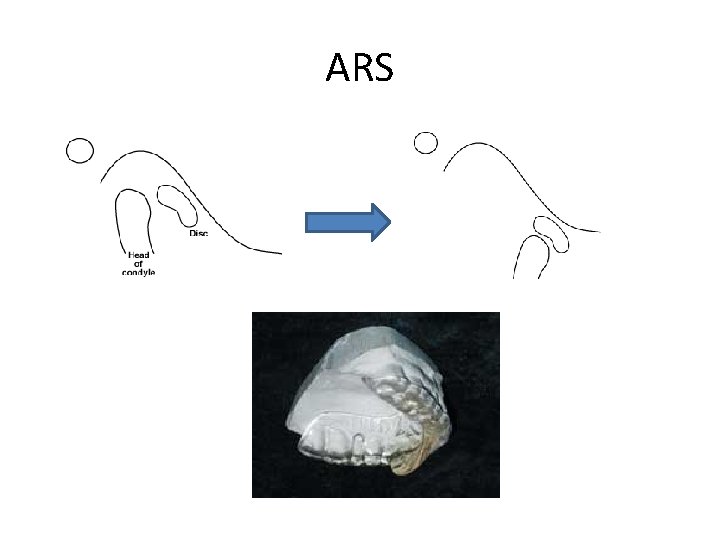 ARS 