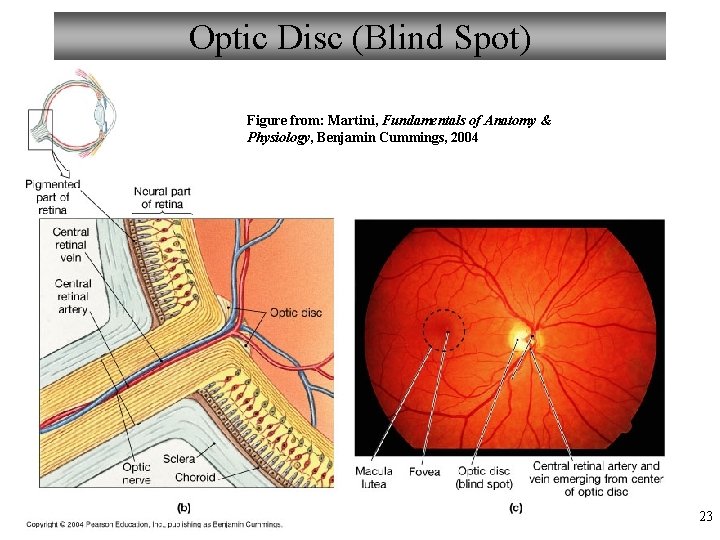 Optic Disc (Blind Spot) Figure from: Martini, Fundamentals of Anatomy & Physiology, Benjamin Cummings,