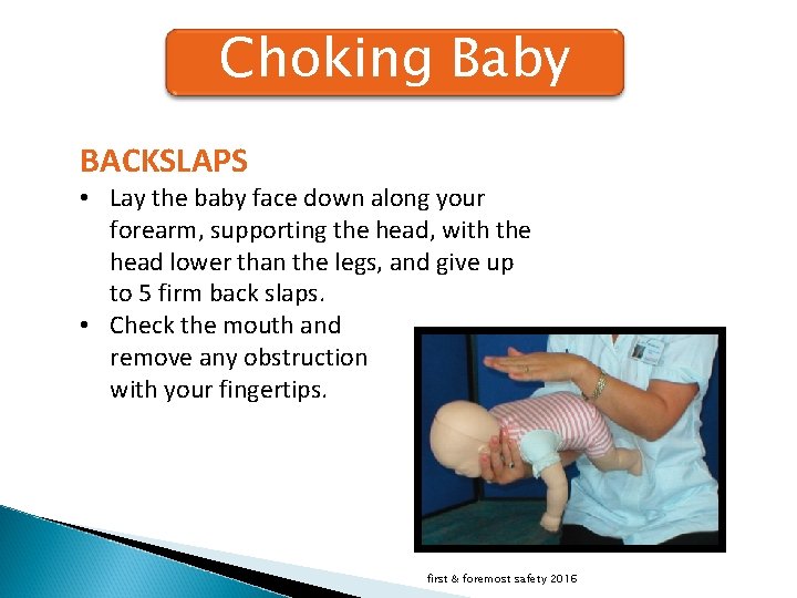 Choking Baby BACKSLAPS • Lay the baby face down along your forearm, supporting the