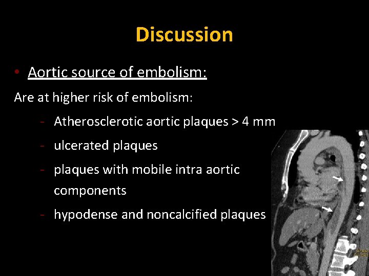 Discussion • Aortic source of embolism: Are at higher risk of embolism: - Atherosclerotic