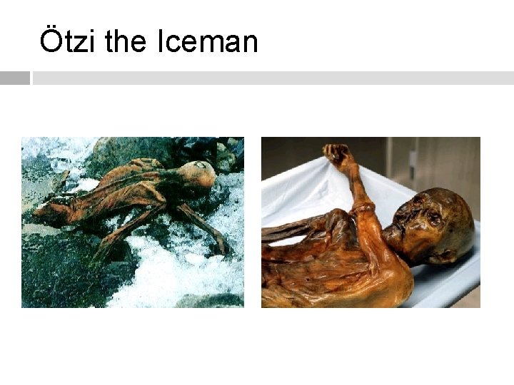 Ötzi the Iceman 