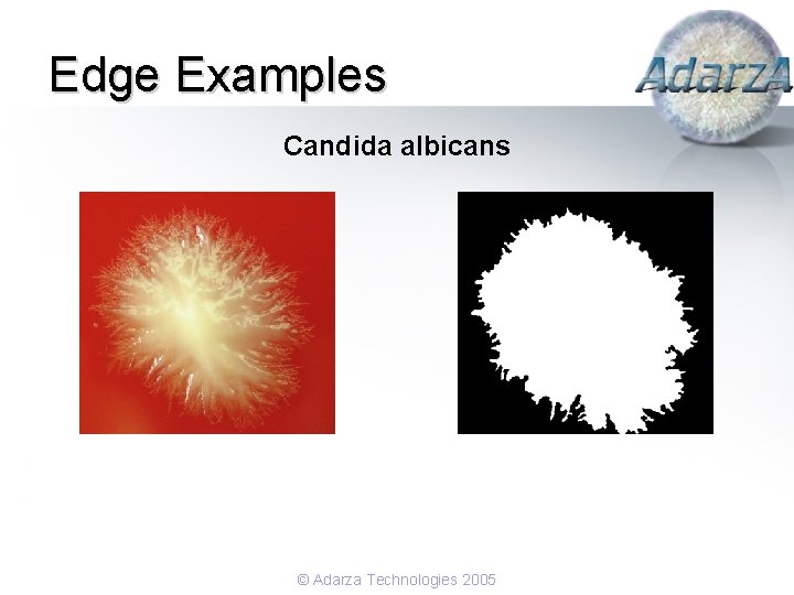 Edge Examples Candida albicans © Adarza Technologies 2005 