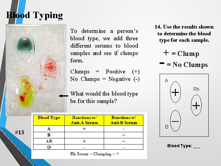 Blood Typing To determine a person’s blood type, we add three different serums to Blood Typing To determine a person’s blood type, we add three different serums to