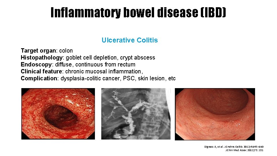 Inflammatory bowel disease (IBD) Ulcerative Colitis Target organ: colon Histopathology: goblet cell depletion, crypt