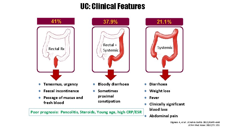 UC: Clinical Features Proctitis 41% Left-sided colitis 37. 9% Pancolitis 21. 1% Rectal Rx