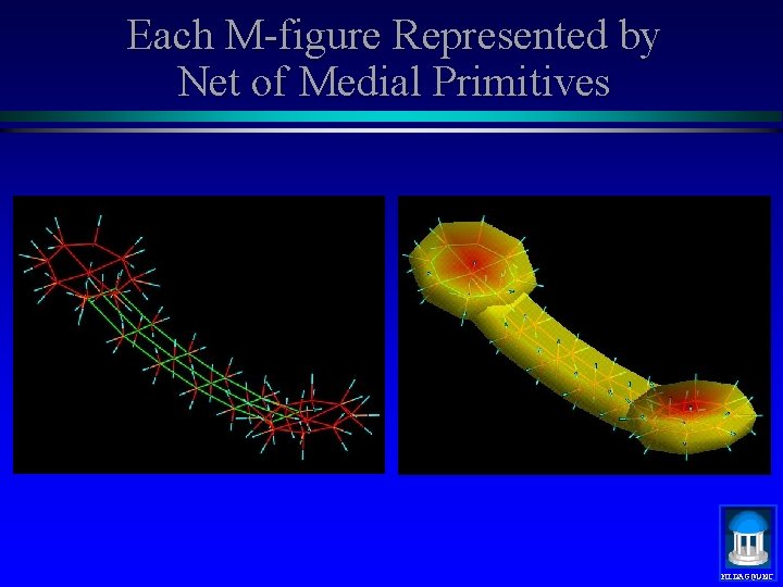 Each M-figure Represented by Net of Medial Primitives MIDAG@UNC 