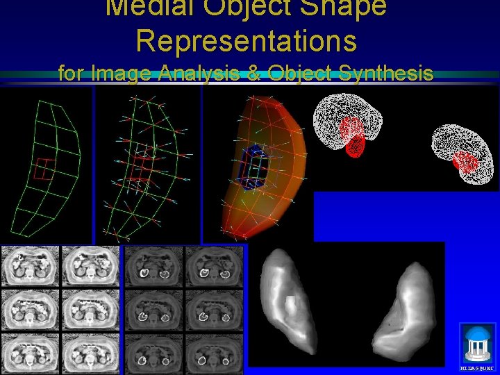 Medial Object Shape Representations for Image Analysis & Object Synthesis MIDAG@UNC 