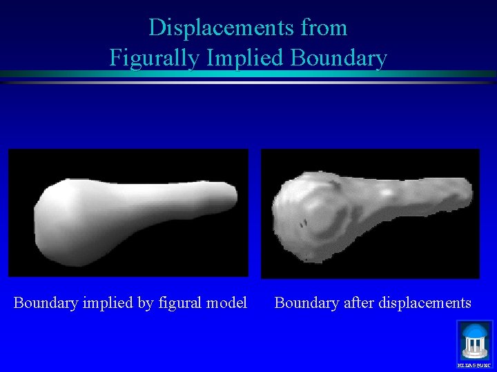 Displacements from Figurally Implied Boundary implied by figural model Boundary after displacements MIDAG@UNC 