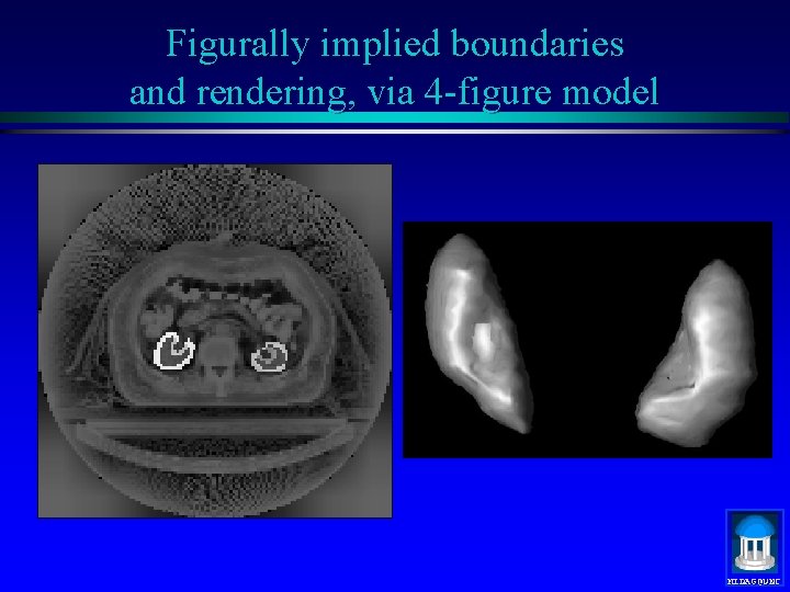 Figurally implied boundaries and rendering, via 4 -figure model MIDAG@UNC 