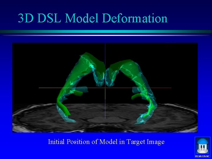 3 D DSL Model Deformation Initial Position of Model in Target Image MIDAG@UNC 