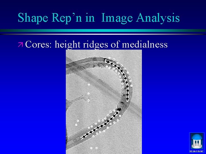 Shape Rep’n in Image Analysis ä Cores: height ridges of medialness MIDAG@UNC 