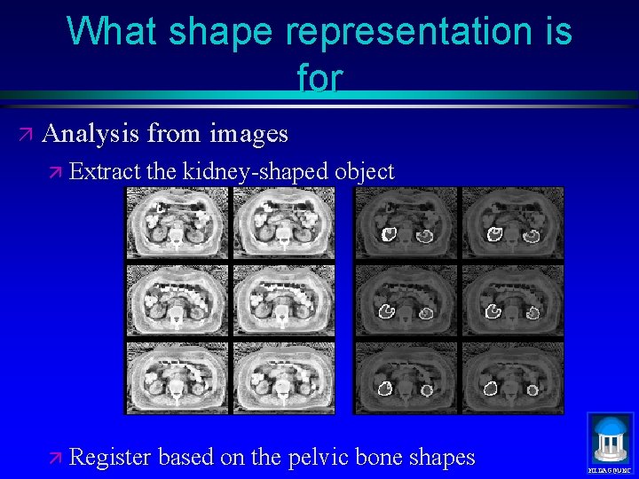 What shape representation is for ä Analysis from images ä Extract the kidney-shaped object