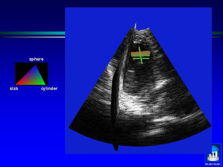 sphere slab cylinder MIDAG@UNC 