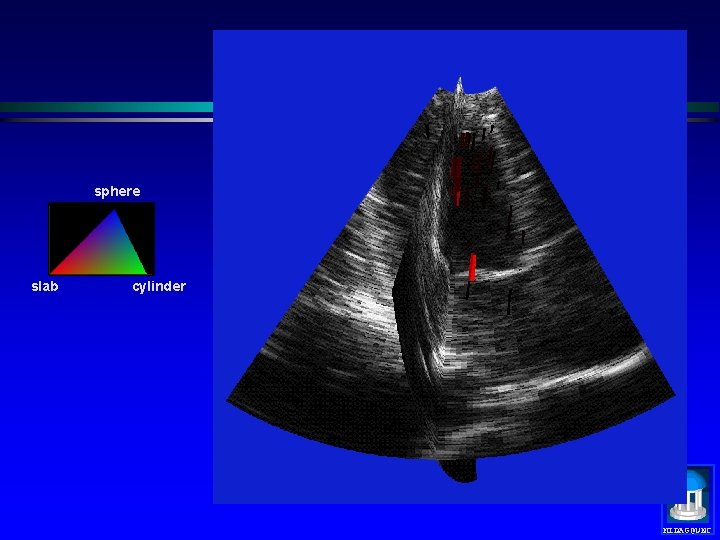 sphere slab cylinder MIDAG@UNC 
