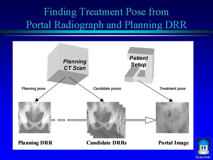 Finding Treatment Pose from Portal Radiograph and Planning DRR MIDAG@UNC 