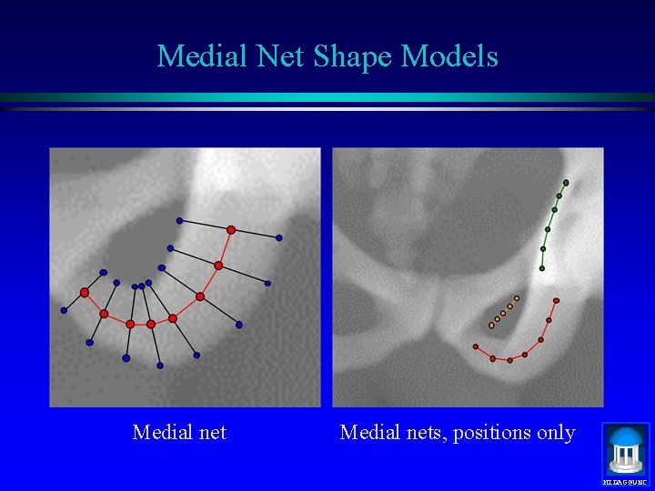 Medial Net Shape Models Medial nets, positions only MIDAG@UNC 