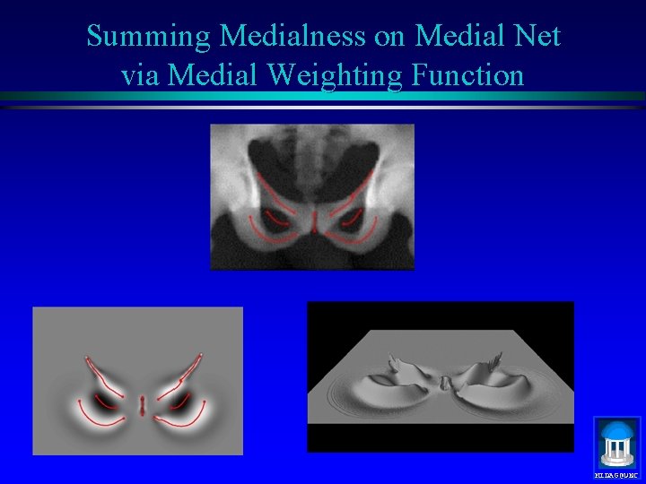 Summing Medialness on Medial Net via Medial Weighting Function MIDAG@UNC 