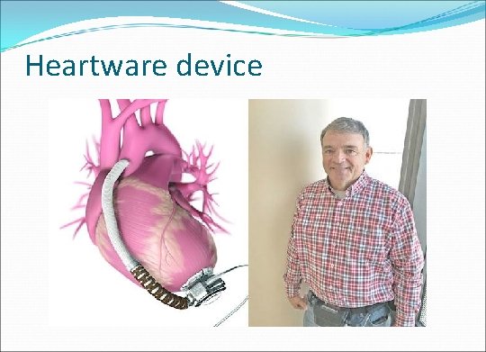 Heartware device 