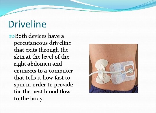 Driveline Both devices have a percutaneous driveline that exits through the skin at the