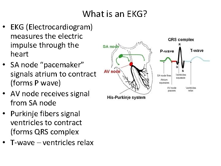 What is an EKG? • EKG (Electrocardiogram) measures the electric impulse through the heart