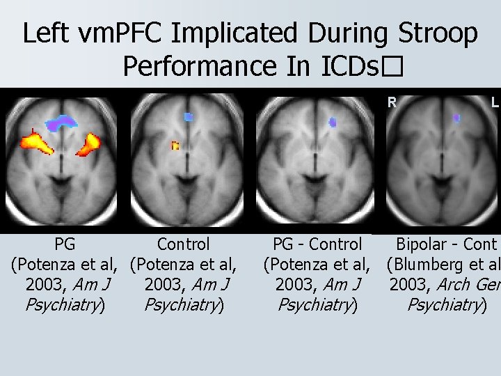 Left vm. PFC Implicated During Stroop Performance In ICDs� R PG Control (Potenza et