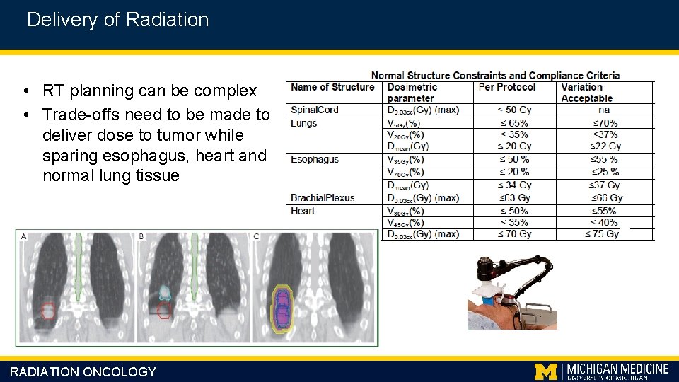 Delivery of Radiation • RT planning can be complex • Trade-offs need to be