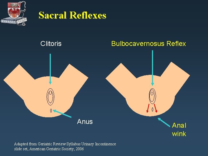 Sacral Reflexes Clitoris Bulbocavernosus Reflex Anus Adapted from Geriatric Review Syllabus Urinary Incontinence slide