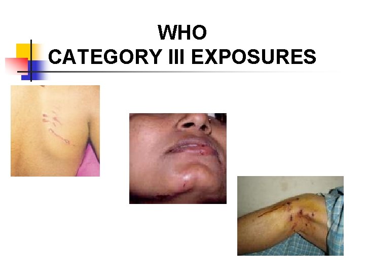 WHO CATEGORY III EXPOSURES 