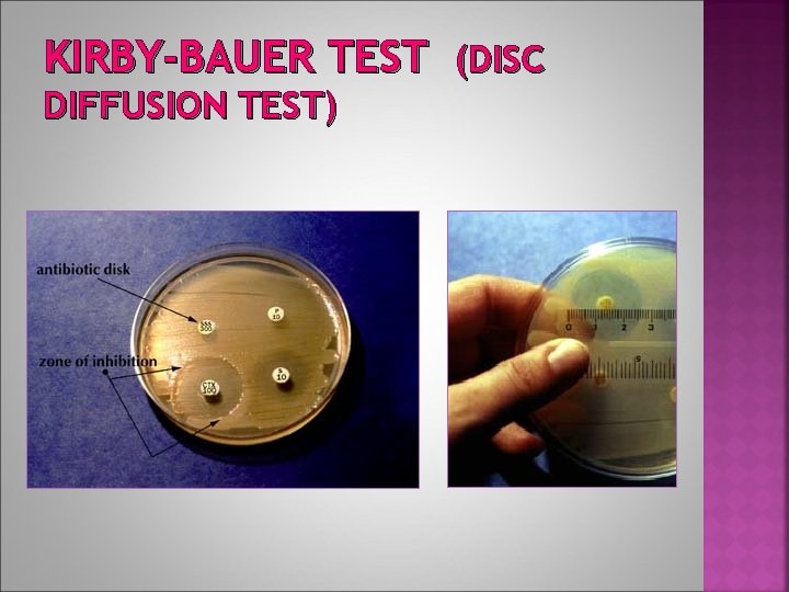 KIRBY-BAUER TEST (DISC DIFFUSION TEST) 