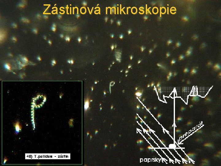 Zástinová mikroskopie 