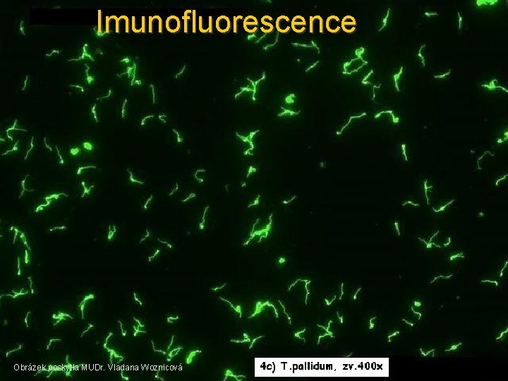 Imunofluorescence Obrázek poskytla MUDr. Vladana Woznicová 