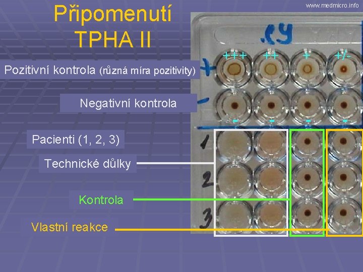 Připomenutí TPHA II Pozitivní kontrola (různá míra pozitivity) www. medmicro. info +++ ++ +