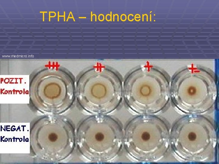 TPHA – hodnocení: www. medmicro. info 